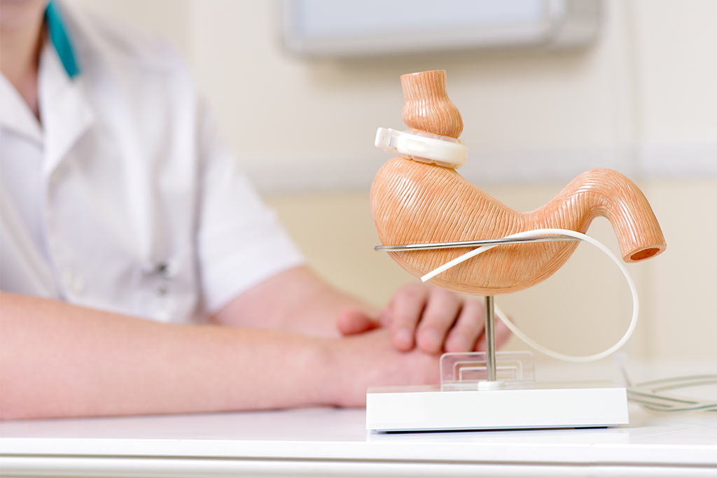 Desvendando Mitos: Verdades e Mentiras Sobre a Cirurgia Bariátrica.